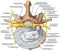 BOARD Stenosis, lumbar disk herniation VS good vertebra