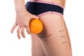 Body with cellulitis and orange fruit