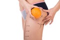 Body with cellulitis and orange fruit Royalty Free Stock Photo