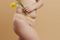 Body imperfections. Real human skin without retouching, acne, stretch marks, cellulite and excess weight. Body Royalty Free Stock Photo