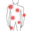 Body Parts Pain Illustration with Shoulders, Chest, Joint, Hips and Muscle Ache on Man Royalty Free Stock Photo