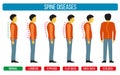 Body posture defect. Vector infographics of spine diseases. Scoliosis and lordosis medical diagrams Royalty Free Stock Photo