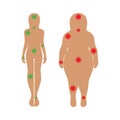 The body of a woman with pain points. Medicine and health, proper nutrition, slimming concepts. Vector illustration