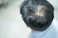 Bold in the middle head and begin no lose hair mature Asian business smart active office man. Royalty Free Stock Photo