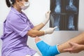 Bone fracture foot and leg on male patient being examined by a woman doctor in a hospital Royalty Free Stock Photo