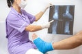 Bone fracture foot and leg on male patient being examined by a woman doctor in a hospital Royalty Free Stock Photo