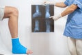 Bone fracture foot and leg on male patient being examined by a woman doctor in a hospital Royalty Free Stock Photo