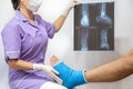 Bone fracture foot and leg on male patient being examined by a woman doctor in a hospital Royalty Free Stock Photo