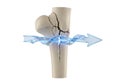 Bone fracture healing visualized with glowing energy flow and arrow Royalty Free Stock Photo