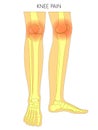 Bone fracture_Knee pain bones of the leg Royalty Free Stock Photo