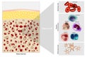 Bone marrow Stem cell. Platelets, Red and White blood cells.