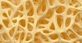 Bone osteoporosis animation