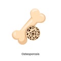 bone osteoporosis health problem medical disease sponge anatomy arthritis