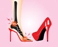 Medical infographic orthopedic. Symptom pain caused by wearing high heels makes bone and muscle damage.