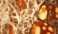 Bone structure in osteoporosis. vitamin D deficiency, fractures, estrogen