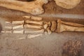 the bones of the human hand