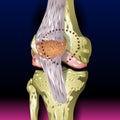 Bones Pain, Injury and Inflammation, Knee Joint Pain Silhouette Icon Ache of Knee, Leg Skeleton, Arthritis, Osteoporosis