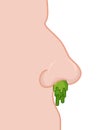Booger nose. Green slime dripping from his nostril. Large Snot