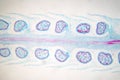 Botanical study of Selaginella strobilus under microscopic view