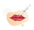 Botulinum Toxin Injection on Lips - Stock Illustration