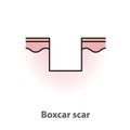 Boxcar scar, atrophic scar, type of acne scar on skin surface vector isolated on white background