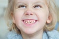 Boy. Bad teeth. Royalty Free Stock Photo