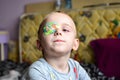 Boy with Eyepatch Royalty Free Stock Photo