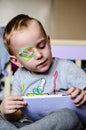 Boy with Eyepatch Royalty Free Stock Photo