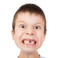 Boy face closeup with a lost tooth Royalty Free Stock Photo