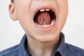 Boy, kid opened his mouth, oral cavity, close-up teeth, performs articulation exercises for the tongue, vocals, dental concept,