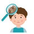 Boy with lice. Magnifying glass close up of a head.