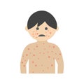 Boy with Measles