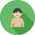 Boy with Measles