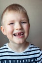 Boy missing milk teeth Royalty Free Stock Photo