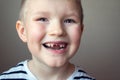 Boy missing milk teeth Royalty Free Stock Photo