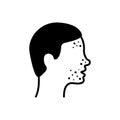 Boy with Pimples on Face Silhouette Icon. Man with Blackhead, Acne, Rash Pictogram. Dermatologic Problem, Allergy