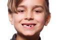 Boy portrait with a lost tooth Royalty Free Stock Photo