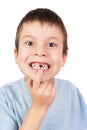 Boy portrait with a lost tooth Royalty Free Stock Photo