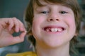 The boy's milk tooth fell out. A satisfied child holds a tooth in his hand. A hole in the gum is visible Royalty Free Stock Photo