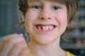 The boy's milk tooth fell out. A satisfied child holds a tooth in his hand. A hole in the gum is visible Royalty Free Stock Photo