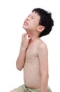 Boy scratching his allergic skin