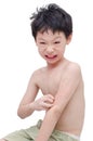 Boy scratching his allergic skin