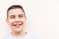 boy showing his lost milk tooth, close up Royalty Free Stock Photo