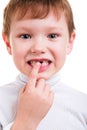 Boy showing his missing milk teeth Royalty Free Stock Photo