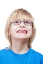 Boy showing missing milk teeth Royalty Free Stock Photo