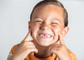 Boy showing missing teeth.