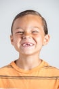 Boy showing missing teeth.