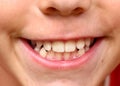 Boy smile with strong white teeth photo