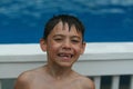 Boy smiling with missing teeth