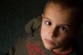 Boy with Strabismus Royalty Free Stock Photo